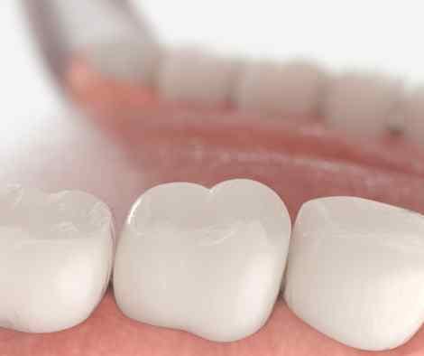 Cleaning tooth before sealant