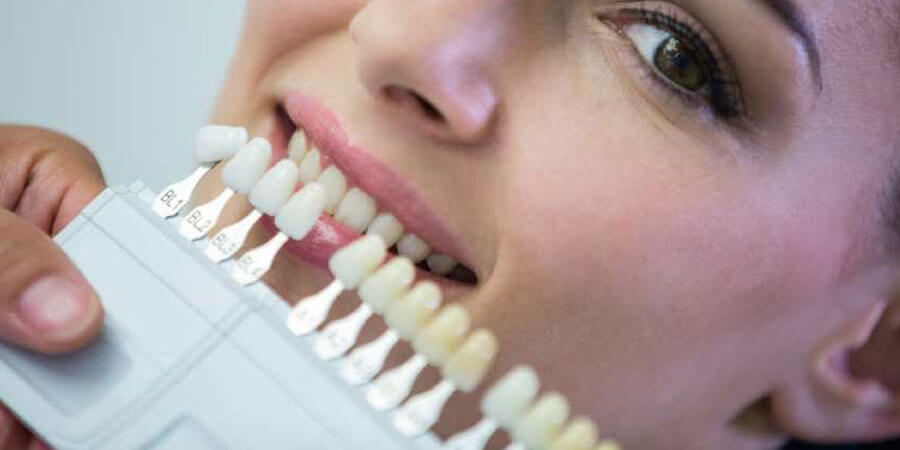 Patient with a beautiful, bright smile from dental veneers