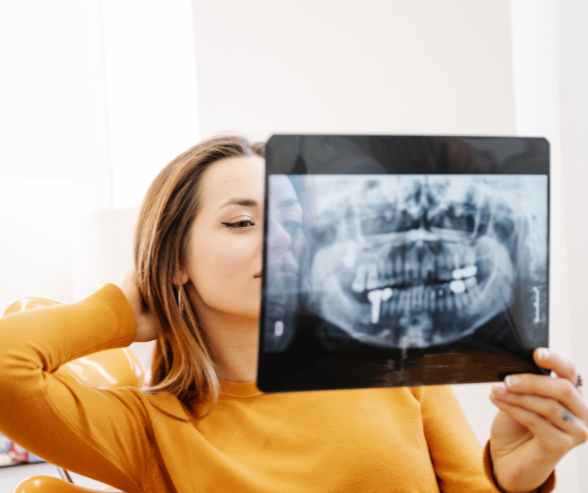 1. A woman holds an X-ray image of her teeth, examining the dental details with a focused expression.